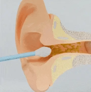 Smart Otocam Ear Cleaning Tool with Camera