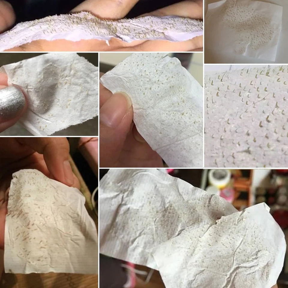 DermaStrips™ - 60PCS Blackhead/Whitehead Pore Strips