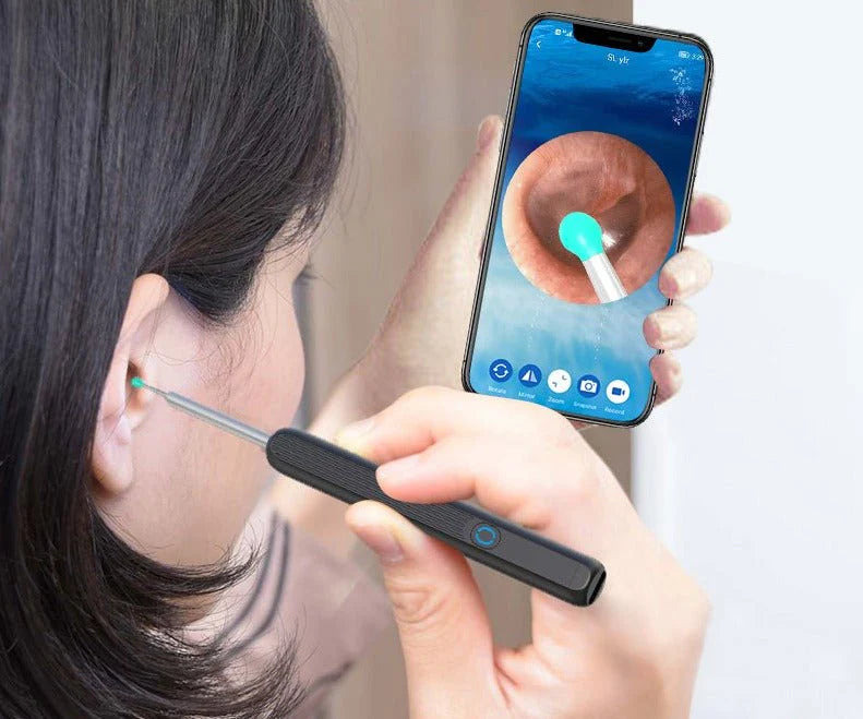 Smart Otocam Ear Cleaning Tool with Camera
