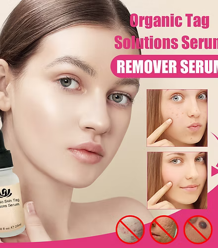 Fast Acting Organic Skin Tag Removal Serum