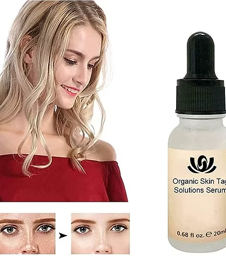 Fast Acting Organic Skin Tag Removal Serum