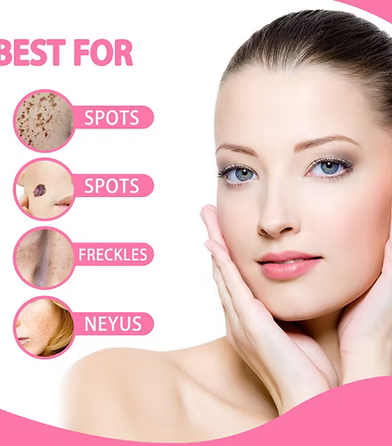 Fast Acting Organic Skin Tag Removal Serum