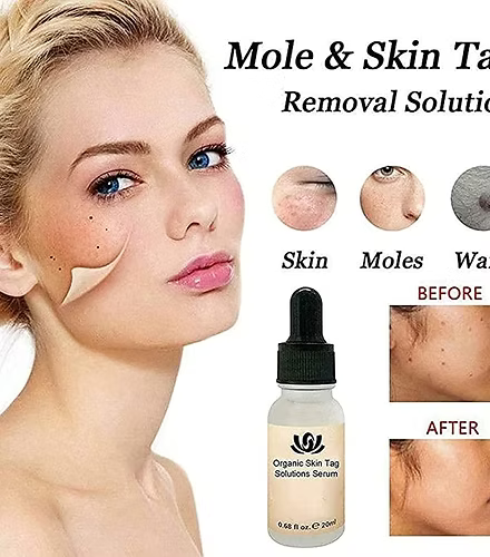 Fast Acting Organic Skin Tag Removal Serum