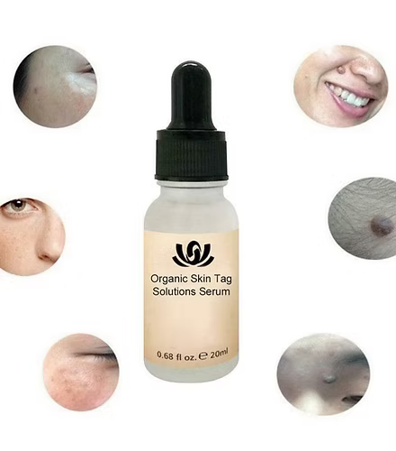 Fast Acting Organic Skin Tag Removal Serum