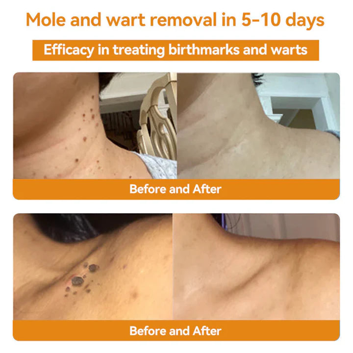 TagRecede Bee Venom Spray for Skin Renewal