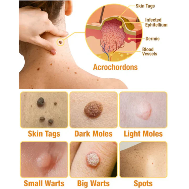 TagRecede Bee Venom Spray for Skin Renewal