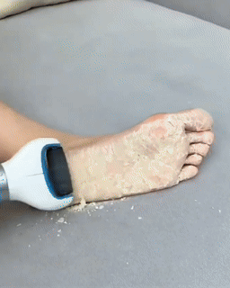 USB Foot Callus Remover Pedicure Tool for Home