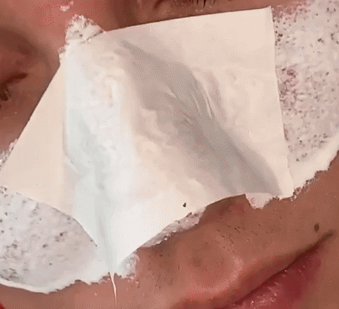  DermaStrips™ - 60PCS Blackhead/Whitehead Pore Strips