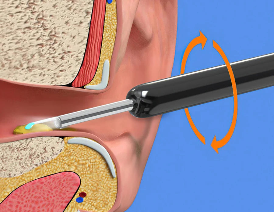 Smart Otocam Ear Cleaning Tool with Camera